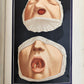 1895 PICTORIAL ATLAS of SKIN DISEASES & SYPHILITIC AFFECTION antique ILLUSTRATED
