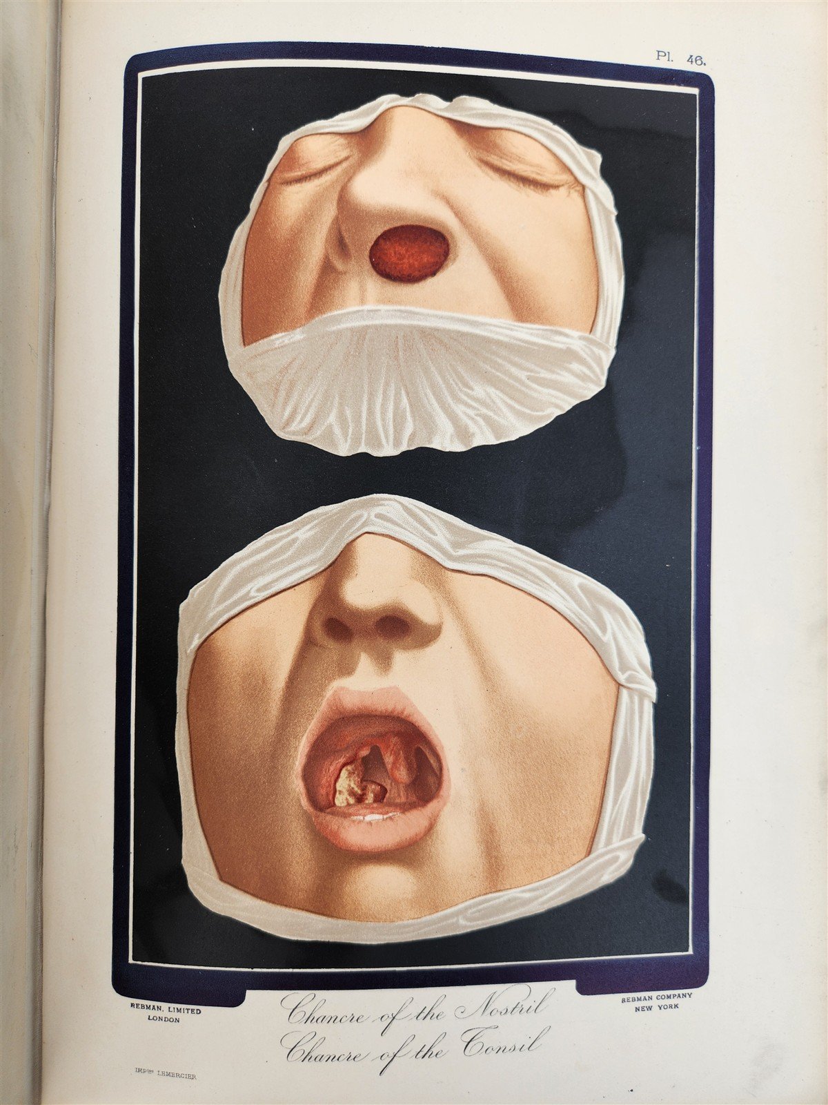 1895 PICTORIAL ATLAS of SKIN DISEASES & SYPHILITIC AFFECTION antique ILLUSTRATED