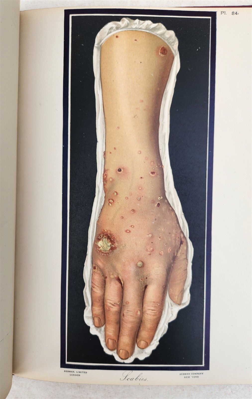 1895 PICTORIAL ATLAS of SKIN DISEASES & SYPHILITIC AFFECTION antique ILLUSTRATED