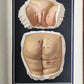 1895 PICTORIAL ATLAS of SKIN DISEASES & SYPHILITIC AFFECTION antique ILLUSTRATED