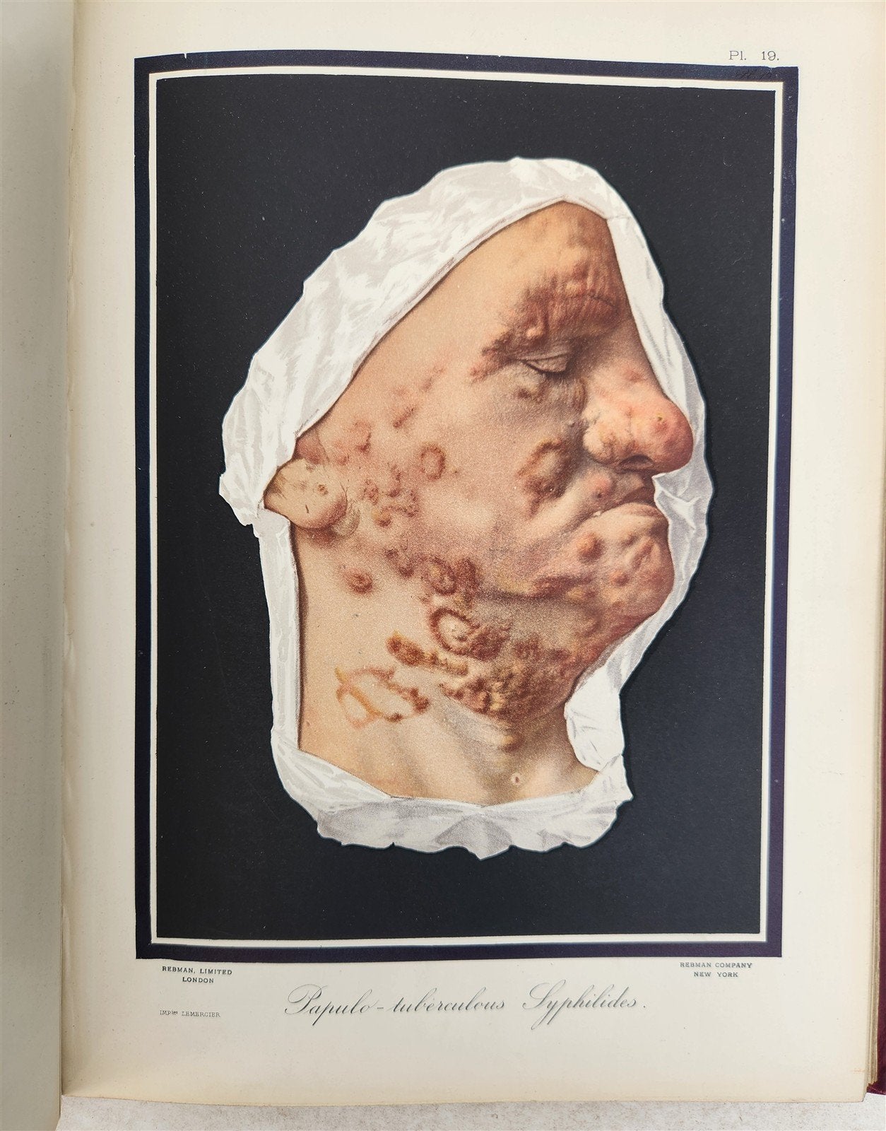 1895 PICTORIAL ATLAS of SKIN DISEASES & SYPHILITIC AFFECTION antique ILLUSTRATED
