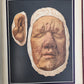 1895 PICTORIAL ATLAS of SKIN DISEASES & SYPHILITIC AFFECTION antique ILLUSTRATED