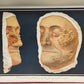 1895 PICTORIAL ATLAS of SKIN DISEASES & SYPHILITIC AFFECTION antique ILLUSTRATED