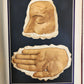 1895 PICTORIAL ATLAS of SKIN DISEASES & SYPHILITIC AFFECTION antique ILLUSTRATED