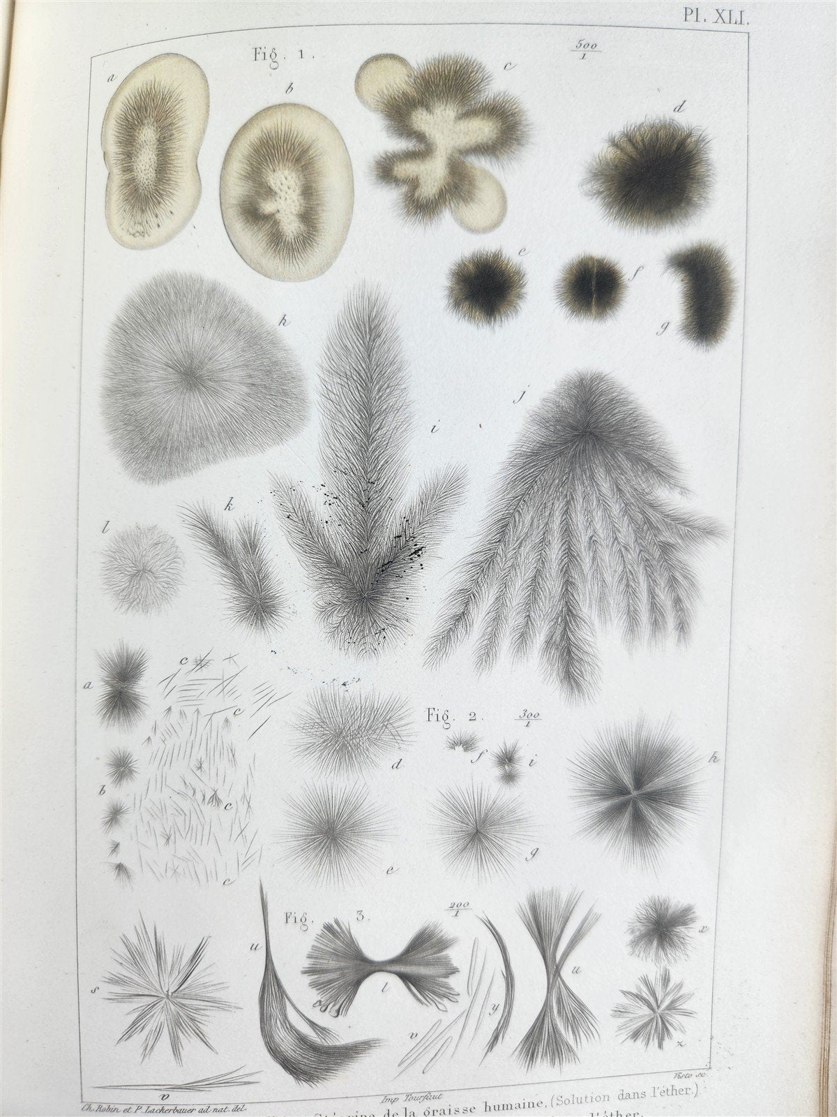 1853 NORMAL & PATHOLOGICAL ANATOMICAL & PHYSIOLOGICAL CHEMISTRY antique ILLUSTR.