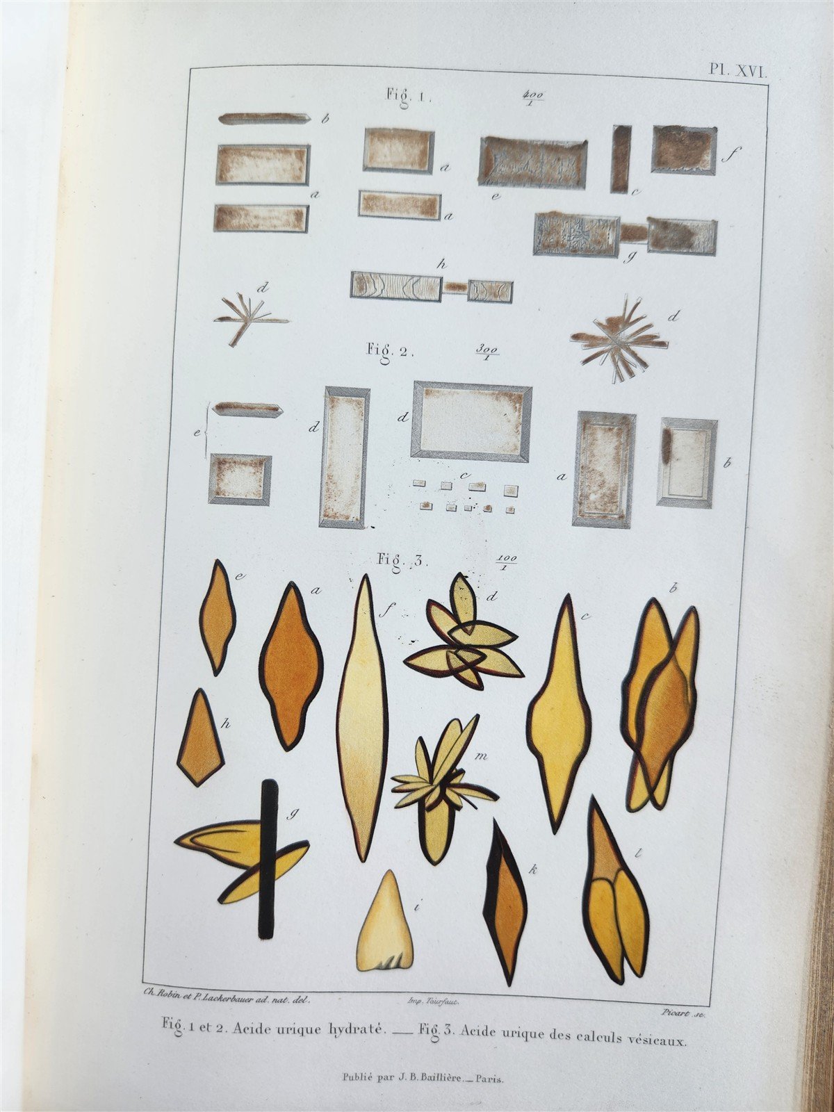 1853 NORMAL & PATHOLOGICAL ANATOMICAL & PHYSIOLOGICAL CHEMISTRY antique ILLUSTR.