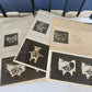 1910 ANATOMY STEREOSCOPIC STUDIES 10 VOLUMES antique by Cunningham & Waterston