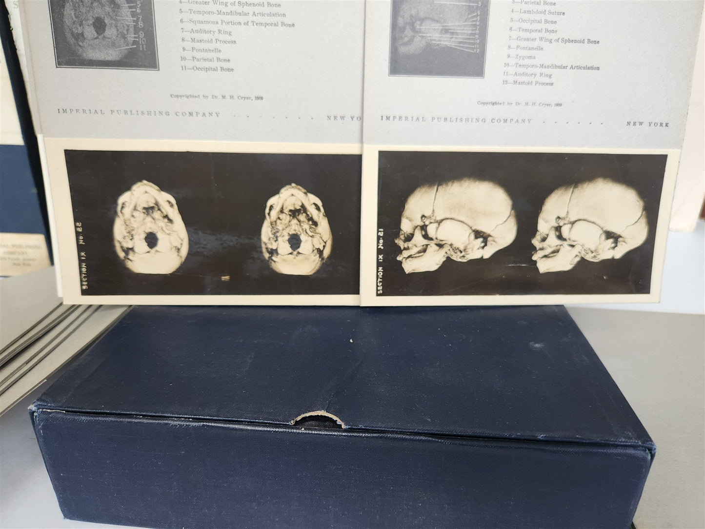 1910 ANATOMY STEREOSCOPIC STUDIES 10 VOLUMES antique by Cunningham & Waterston