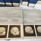 1910 ANATOMY STEREOSCOPIC STUDIES 10 VOLUMES antique by Cunningham & Waterston