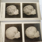 1910 ANATOMY STEREOSCOPIC STUDIES 10 VOLUMES antique by Cunningham & Waterston
