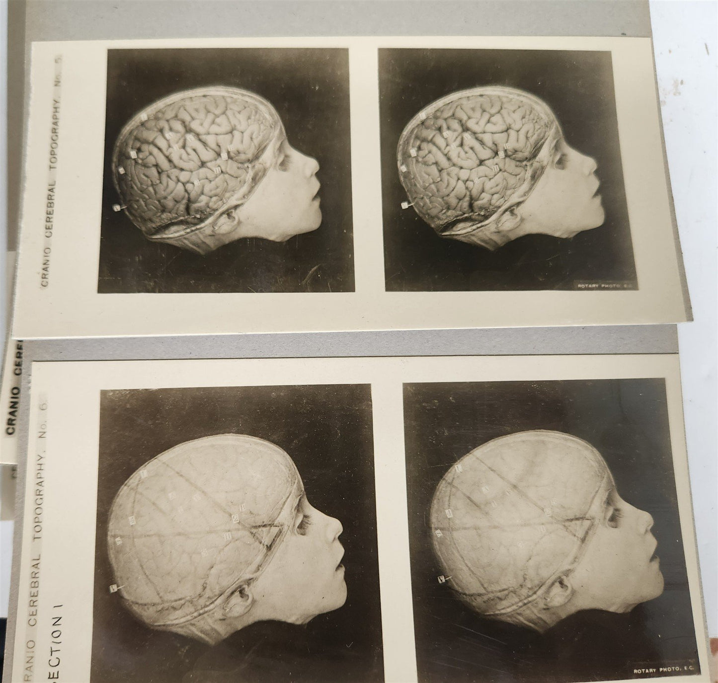 1910 ANATOMY STEREOSCOPIC STUDIES 10 VOLUMES antique by Cunningham & Waterston