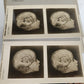 1910 ANATOMY STEREOSCOPIC STUDIES 10 VOLUMES antique by Cunningham & Waterston