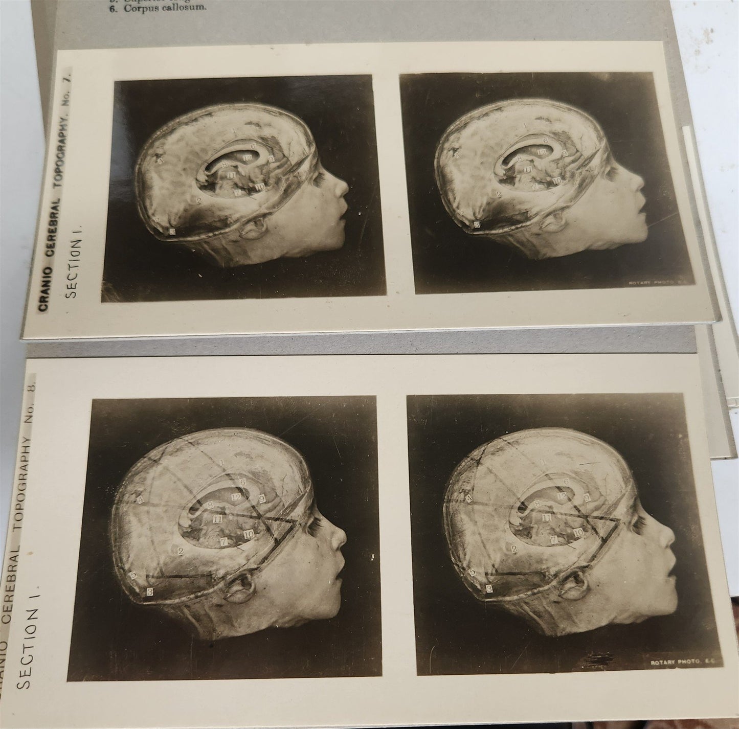 1910 ANATOMY STEREOSCOPIC STUDIES 10 VOLUMES antique by Cunningham & Waterston