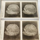 1910 ANATOMY STEREOSCOPIC STUDIES 10 VOLUMES antique by Cunningham & Waterston