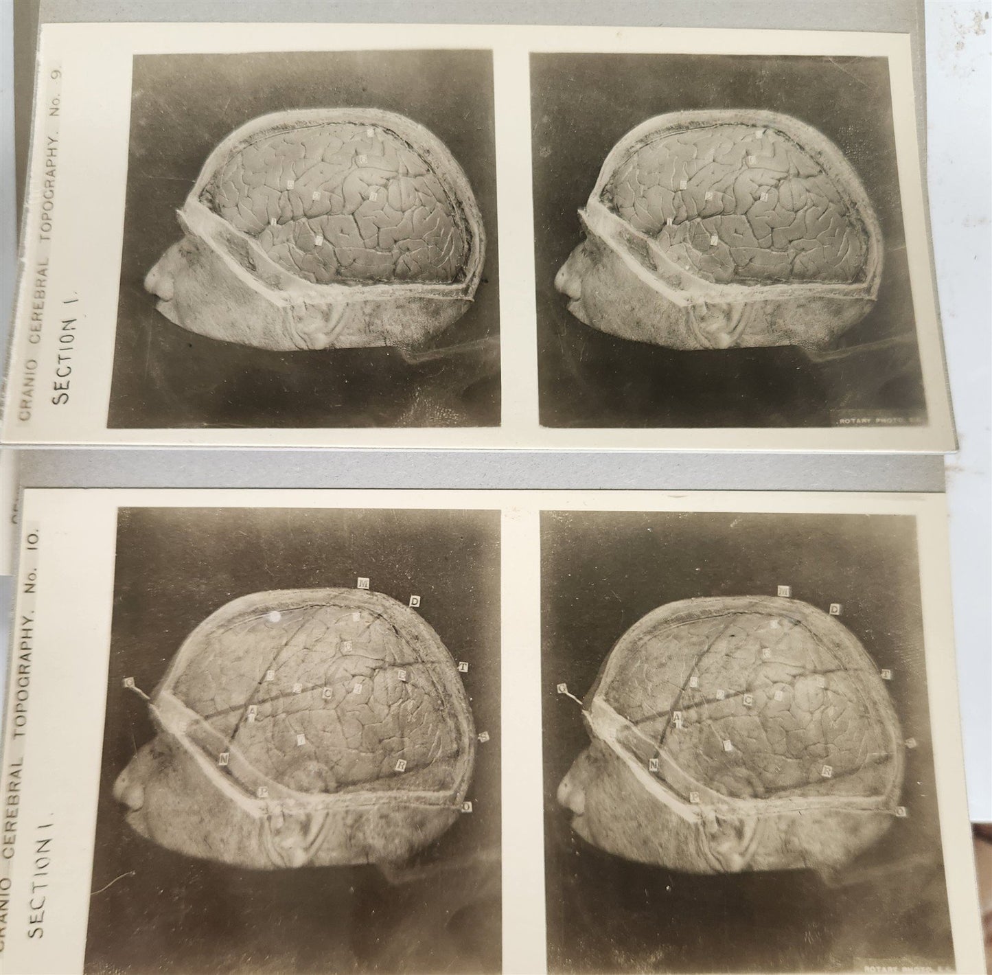 1910 ANATOMY STEREOSCOPIC STUDIES 10 VOLUMES antique by Cunningham & Waterston