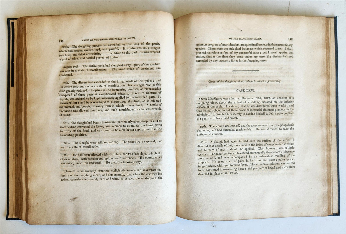 1814 ILLUSTRATED ESSAY on VENEREAL DISEASES confounded with Syphilis antique