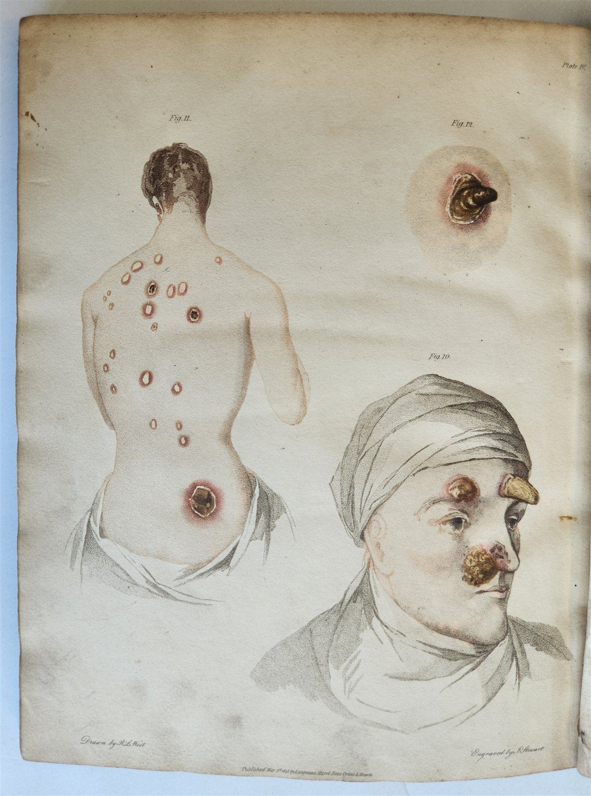 1814 ILLUSTRATED ESSAY on VENEREAL DISEASES confounded with Syphilis antique