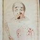 1814 ILLUSTRATED ESSAY on VENEREAL DISEASES confounded with Syphilis antique