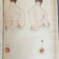 1814 ILLUSTRATED ESSAY on VENEREAL DISEASES confounded with Syphilis antique