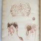 1814 ILLUSTRATED ESSAY on VENEREAL DISEASES confounded with Syphilis antique