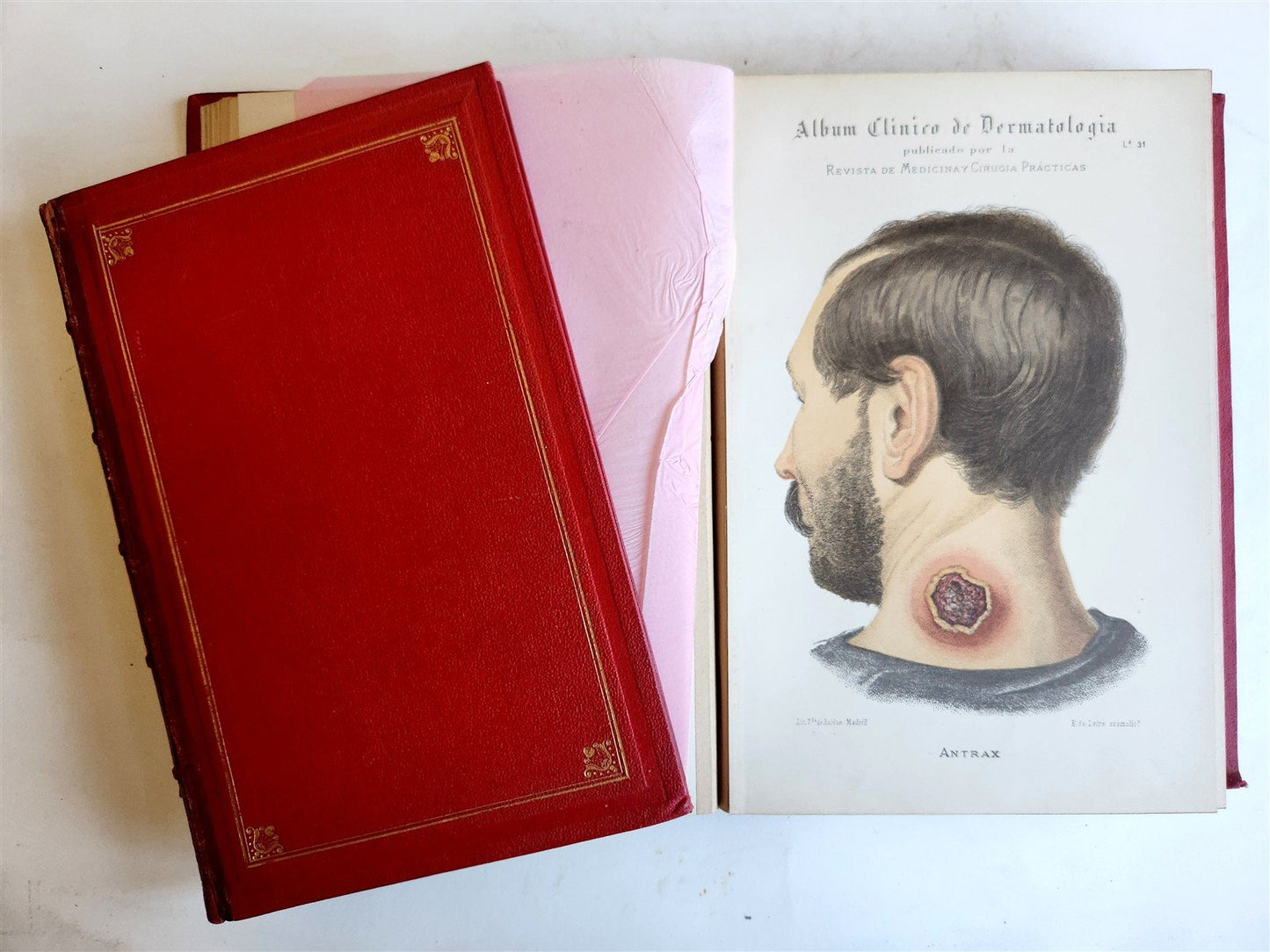 1886 DERMATOLOGY ILLUSTRATED w/ 64 COLOR PLATES 2 VOLUMES in SPANISH antique