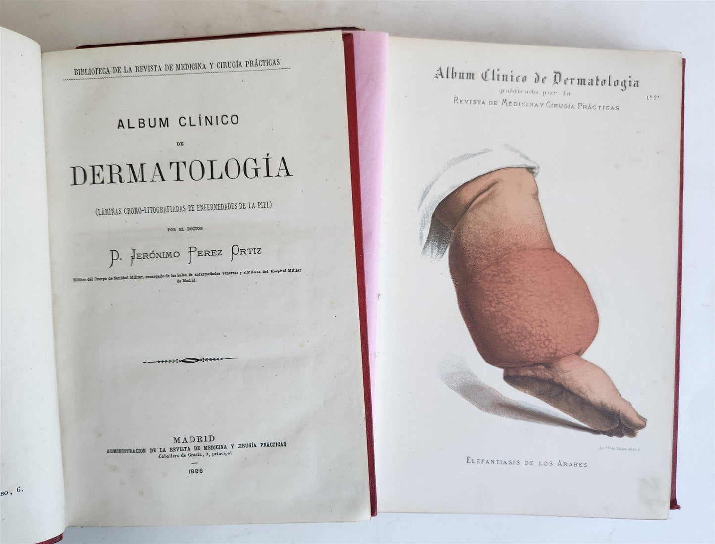 1886 DERMATOLOGY ILLUSTRATED w/ 64 COLOR PLATES 2 VOLUMES in SPANISH antique