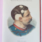 1886 DERMATOLOGY ILLUSTRATED w/ 64 COLOR PLATES 2 VOLUMES in SPANISH antique