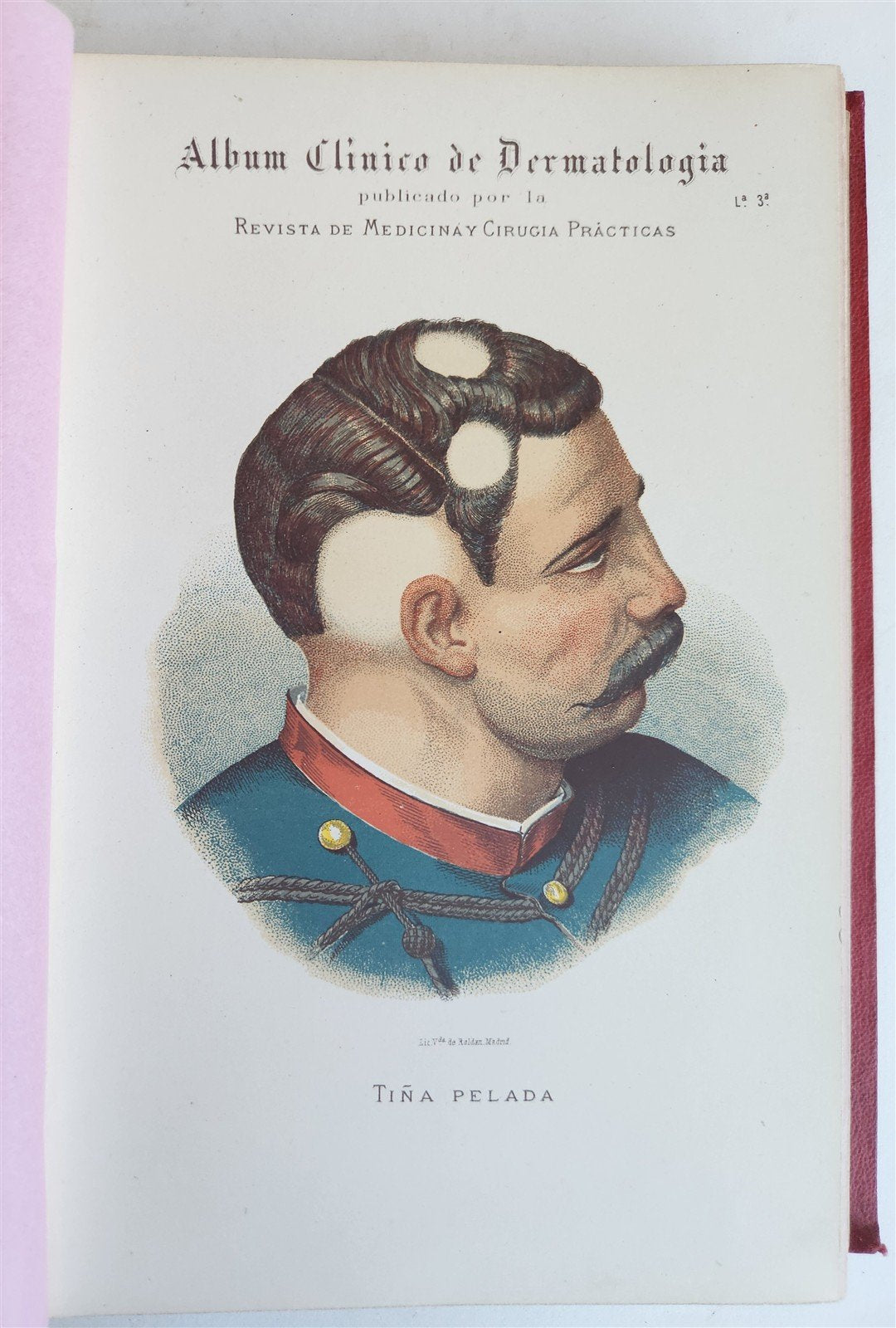 1886 DERMATOLOGY ILLUSTRATED w/ 64 COLOR PLATES 2 VOLUMES in SPANISH antique