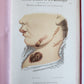 1886 DERMATOLOGY ILLUSTRATED w/ 64 COLOR PLATES 2 VOLUMES in SPANISH antique