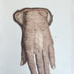1886 DERMATOLOGY ILLUSTRATED w/ 64 COLOR PLATES 2 VOLUMES in SPANISH antique