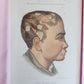 1886 DERMATOLOGY ILLUSTRATED w/ 64 COLOR PLATES 2 VOLUMES in SPANISH antique