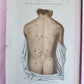 1886 DERMATOLOGY ILLUSTRATED w/ 64 COLOR PLATES 2 VOLUMES in SPANISH antique
