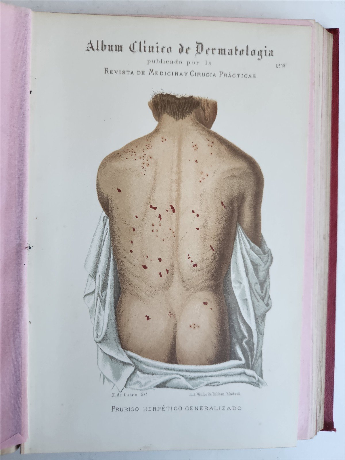 1886 DERMATOLOGY ILLUSTRATED w/ 64 COLOR PLATES 2 VOLUMES in SPANISH antique