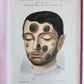 1886 DERMATOLOGY ILLUSTRATED w/ 64 COLOR PLATES 2 VOLUMES in SPANISH antique