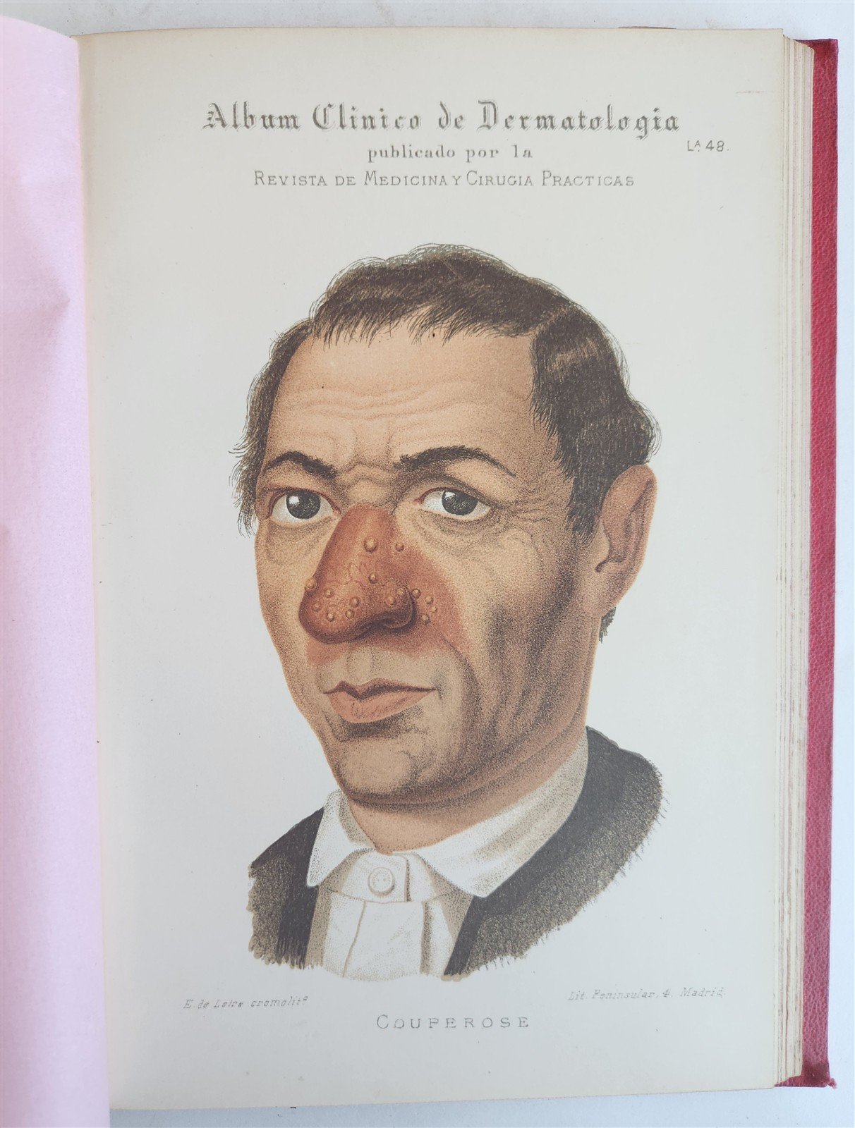 1886 DERMATOLOGY ILLUSTRATED w/ 64 COLOR PLATES 2 VOLUMES in SPANISH antique