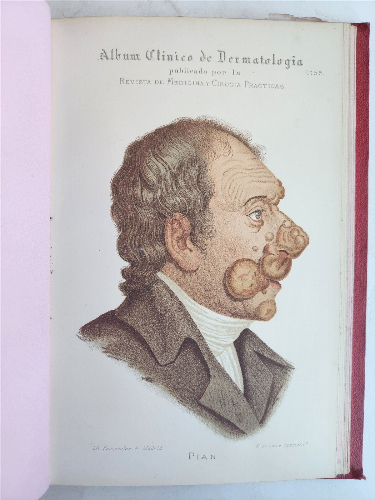 1886 DERMATOLOGY ILLUSTRATED w/ 64 COLOR PLATES 2 VOLUMES in SPANISH antique