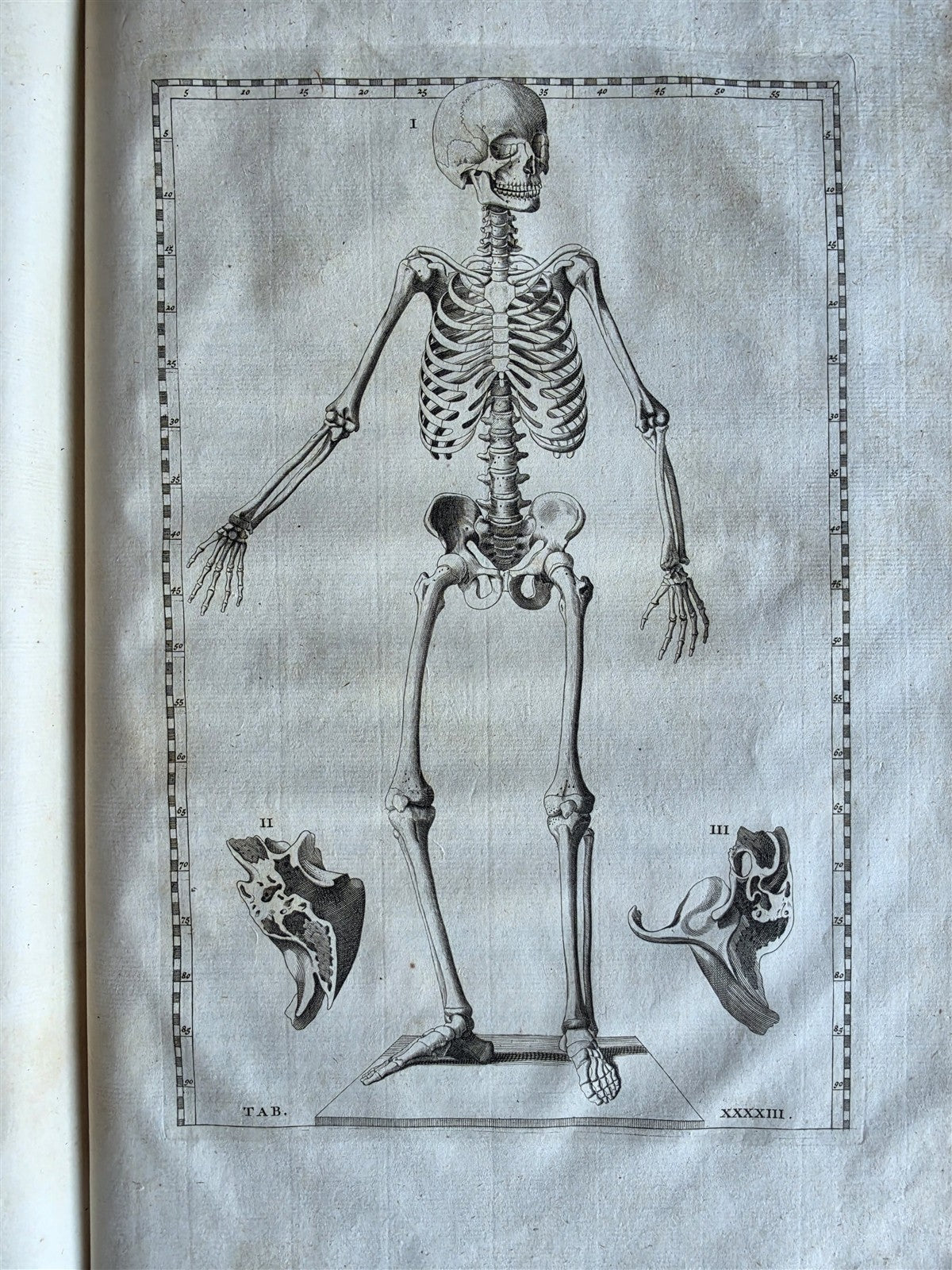1744 ANATOMICAL TREATISE Tabularum Anatomicarum ILLUSTRATED FOLIO antique