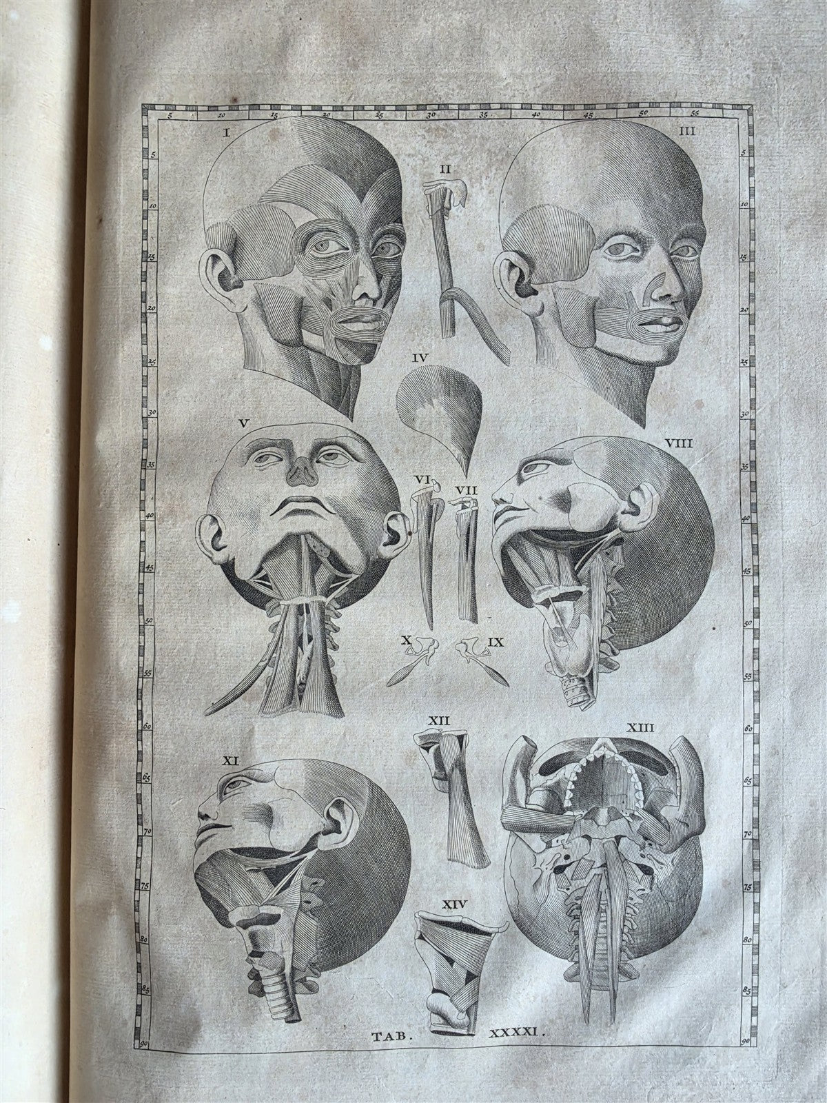 1744 ANATOMICAL TREATISE Tabularum Anatomicarum ILLUSTRATED FOLIO antique