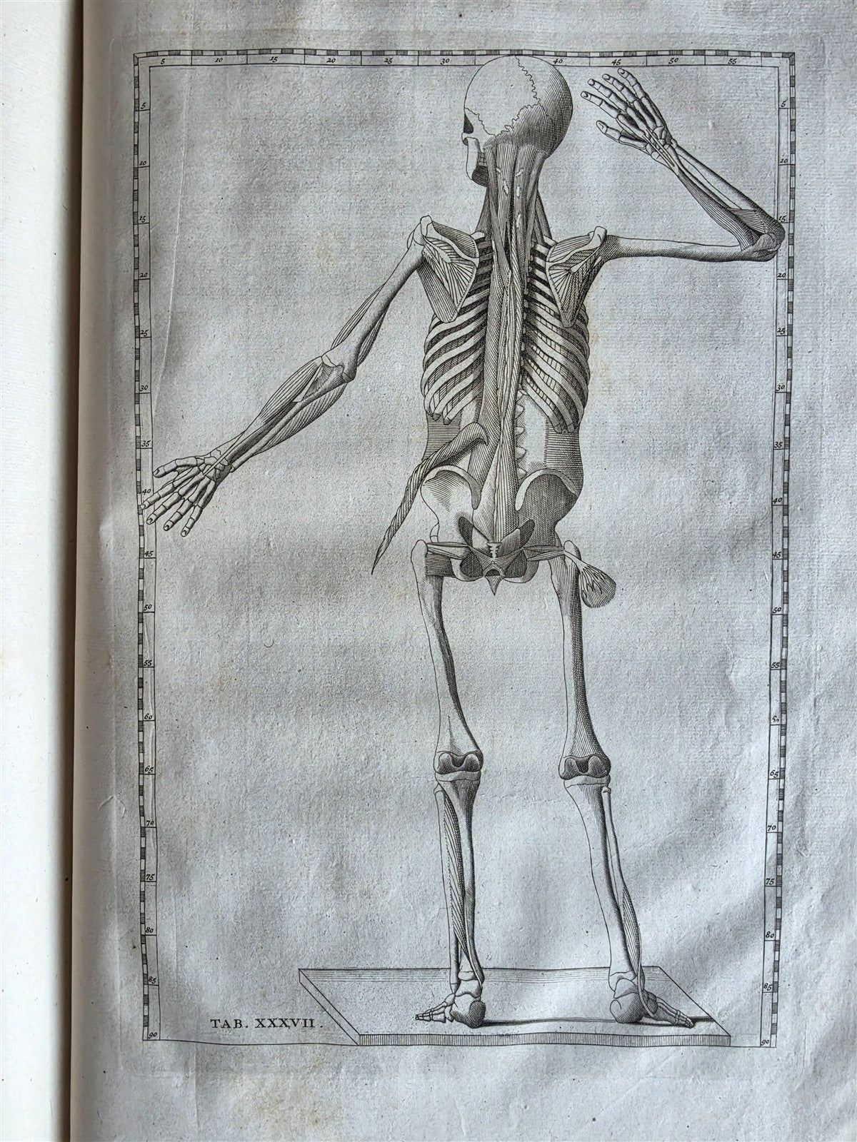 1744 ANATOMICAL TREATISE Tabularum Anatomicarum ILLUSTRATED FOLIO antique