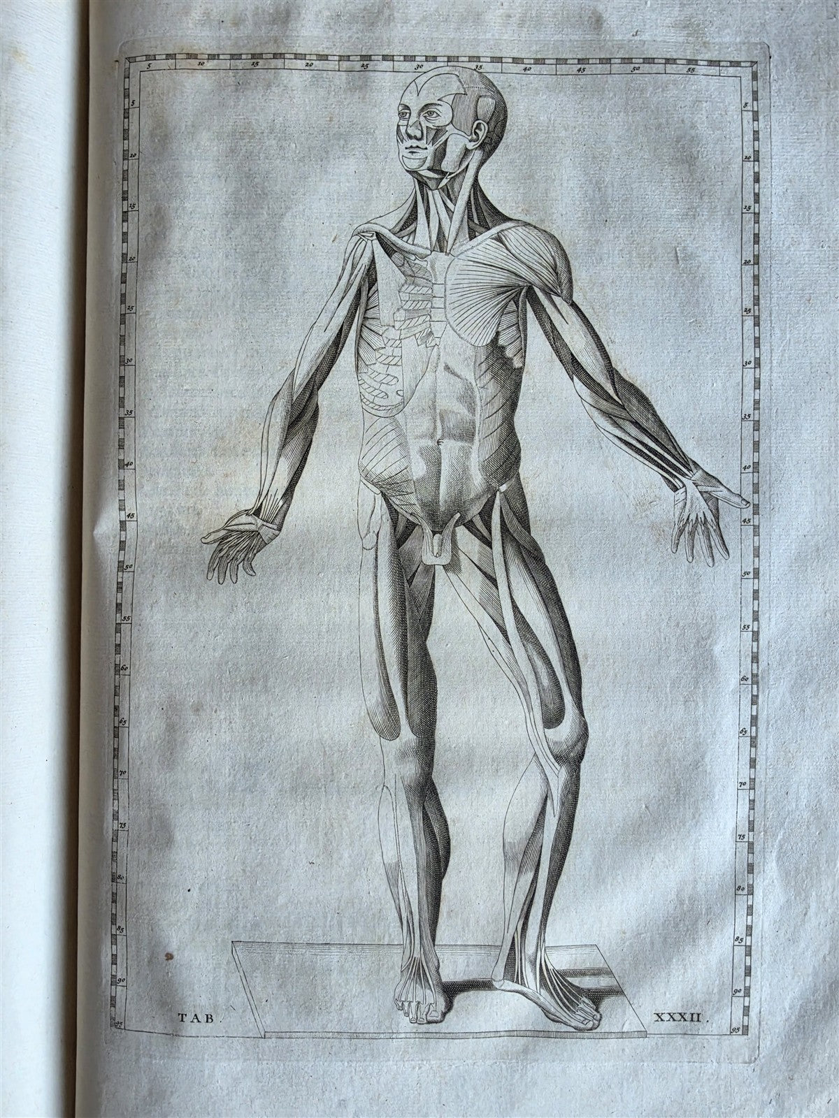 1744 ANATOMICAL TREATISE Tabularum Anatomicarum ILLUSTRATED FOLIO antique
