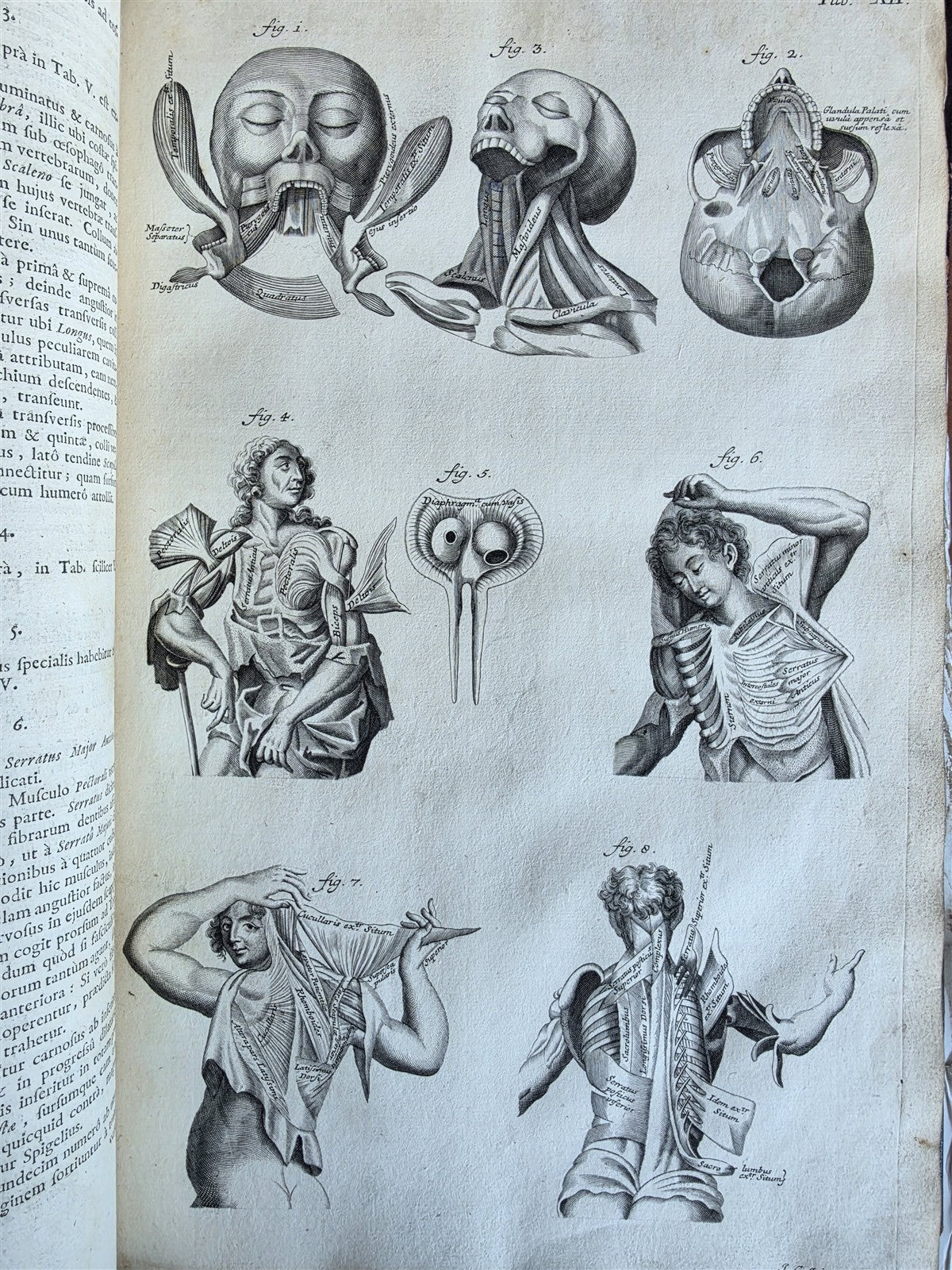 1717 ANATOMICAL TREATISE Theatrum Anatomicum ILLUSTRATED 2 FOLIO VOLUMES antique
