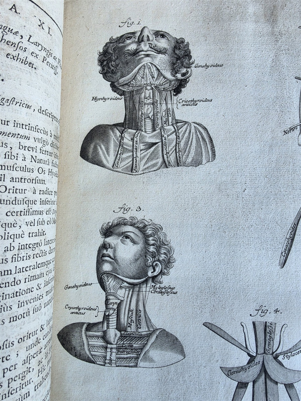 1717 ANATOMICAL TREATISE Theatrum Anatomicum ILLUSTRATED 2 FOLIO VOLUMES antique