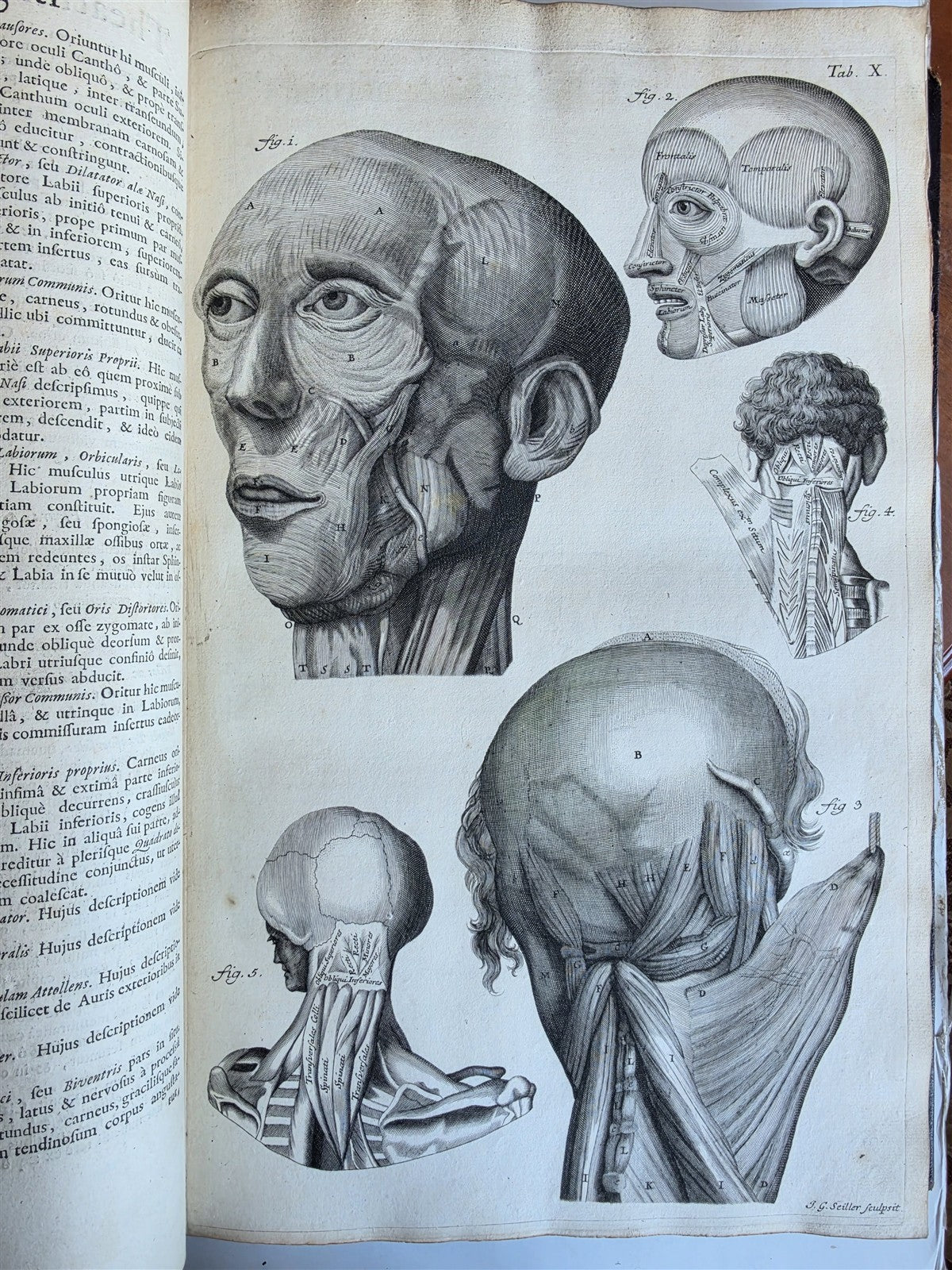 1717 ANATOMICAL TREATISE Theatrum Anatomicum ILLUSTRATED 2 FOLIO VOLUMES antique