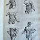 1717 ANATOMICAL TREATISE Theatrum Anatomicum ILLUSTRATED 2 FOLIO VOLUMES antique