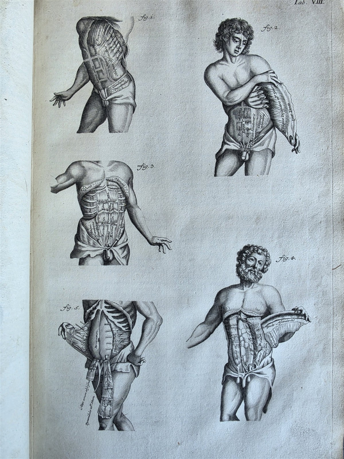 1717 ANATOMICAL TREATISE Theatrum Anatomicum ILLUSTRATED 2 FOLIO VOLUMES antique