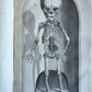 1717 ANATOMICAL TREATISE Theatrum Anatomicum ILLUSTRATED 2 FOLIO VOLUMES antique
