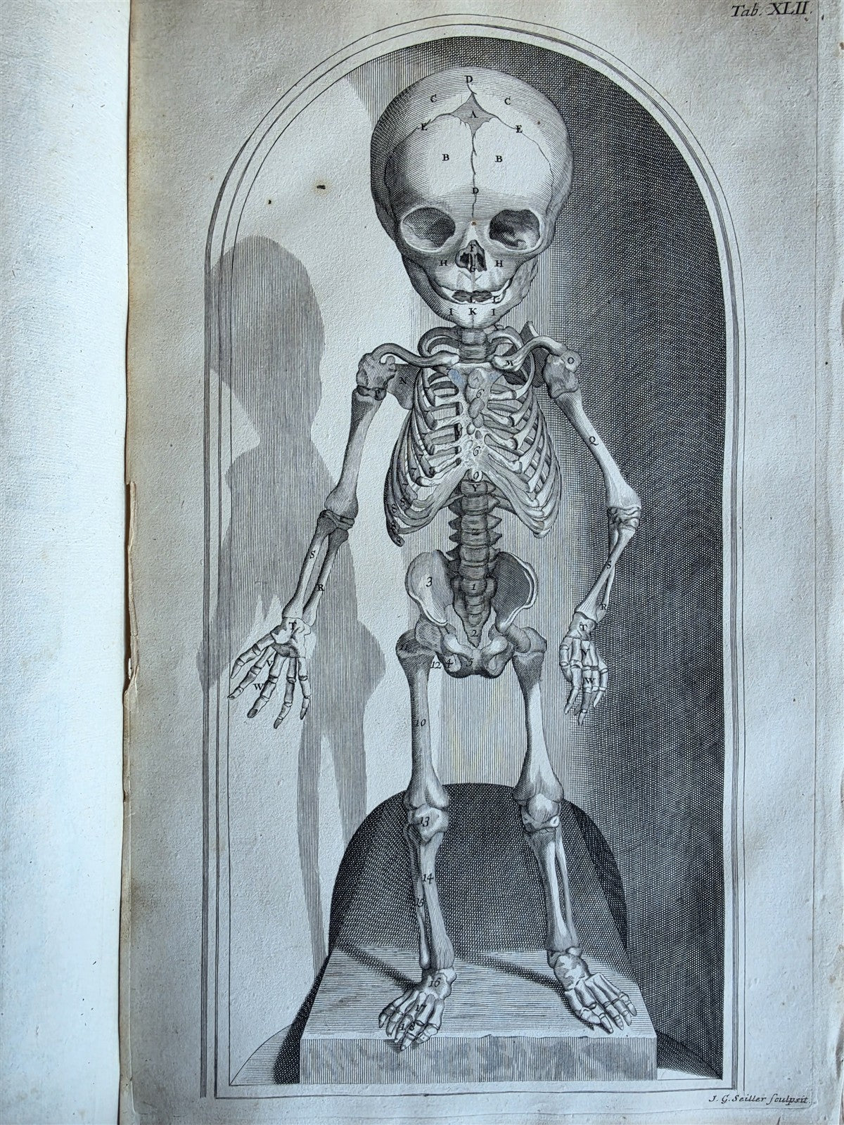 1717 ANATOMICAL TREATISE Theatrum Anatomicum ILLUSTRATED 2 FOLIO VOLUMES antique