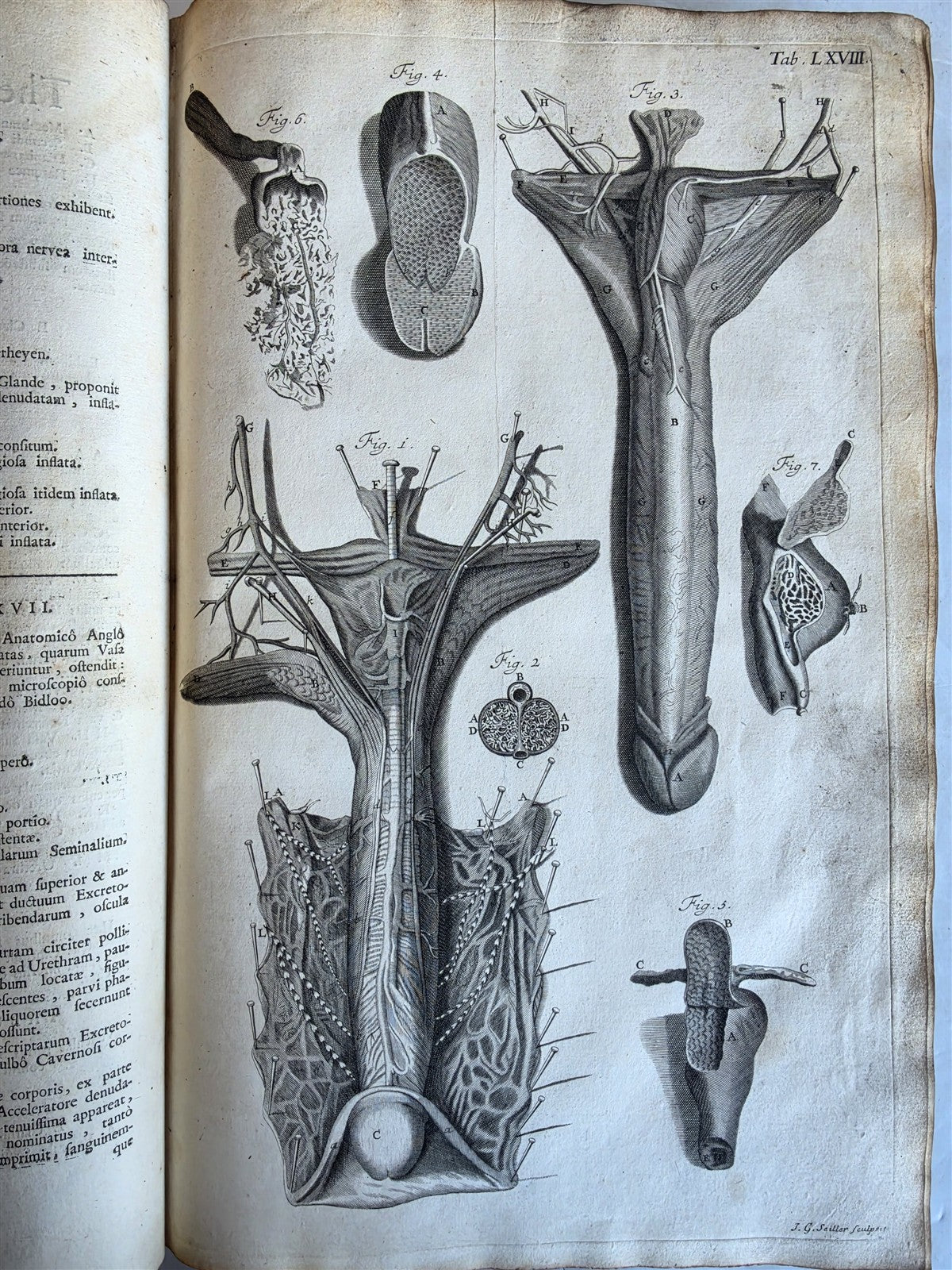 1717 ANATOMICAL TREATISE Theatrum Anatomicum ILLUSTRATED 2 FOLIO VOLUMES antique