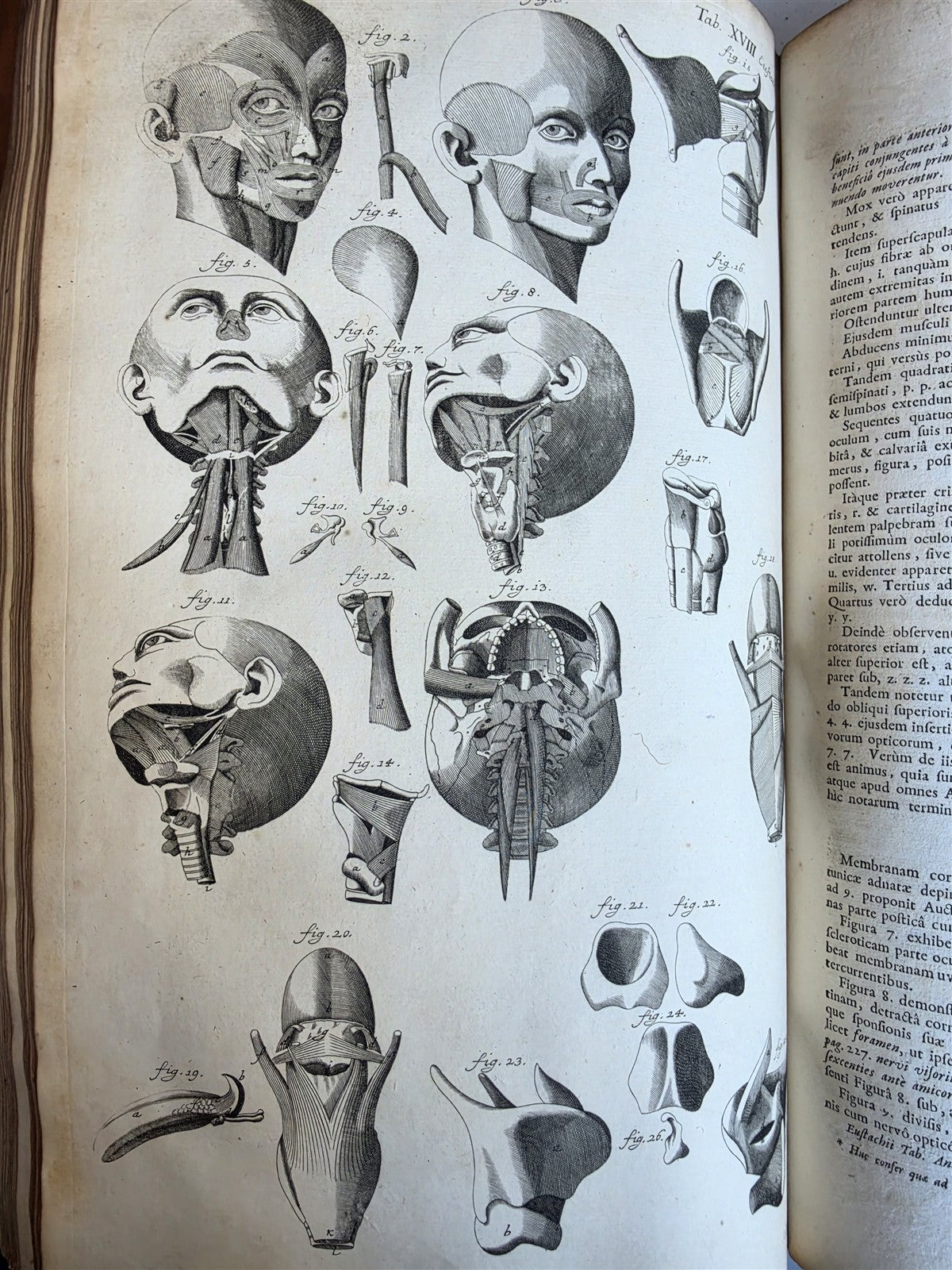 1717 ANATOMICAL TREATISE Theatrum Anatomicum ILLUSTRATED 2 FOLIO VOLUMES antique