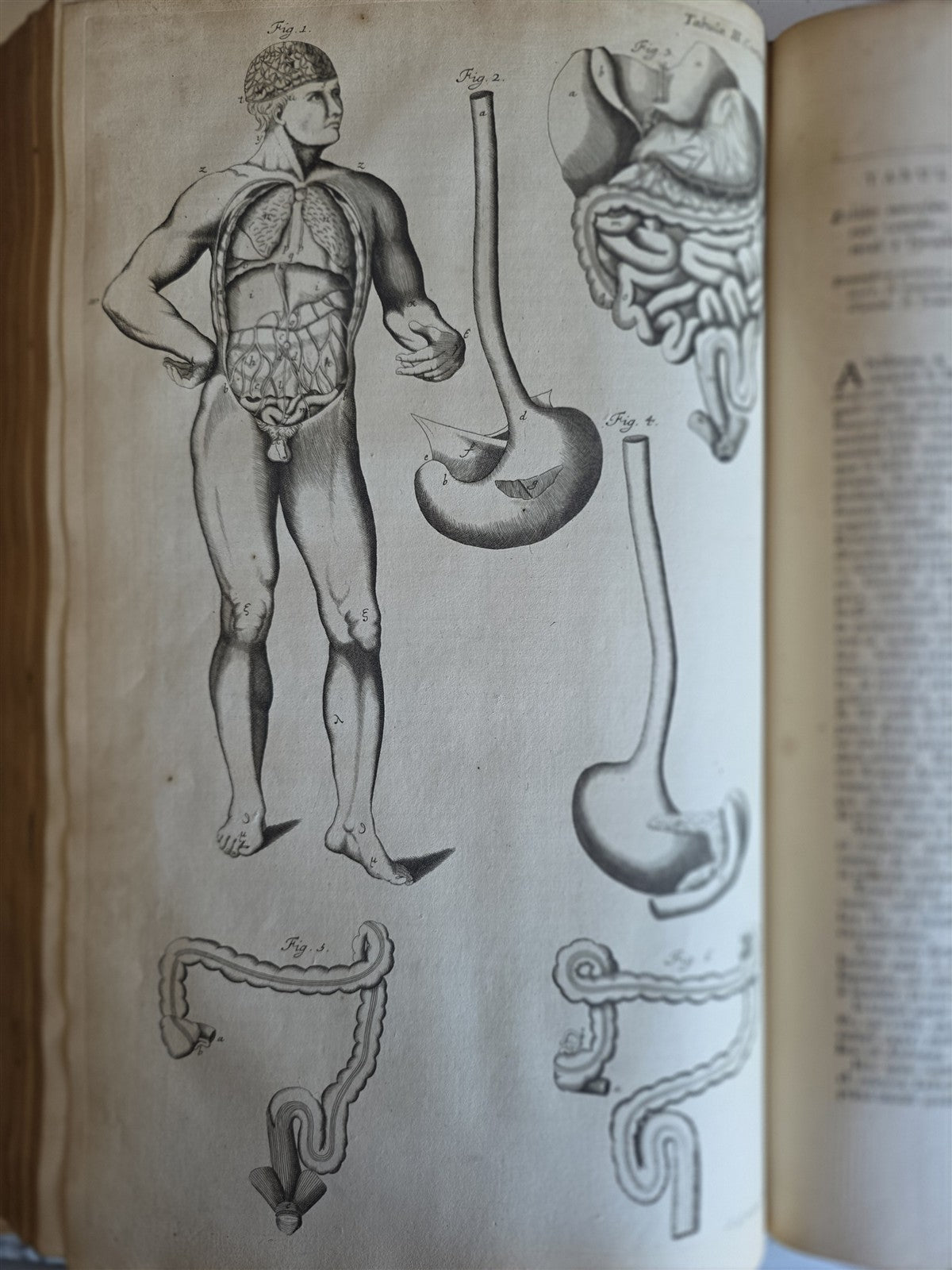 1717 ANATOMICAL TREATISE Theatrum Anatomicum ILLUSTRATED 2 FOLIO VOLUMES antique